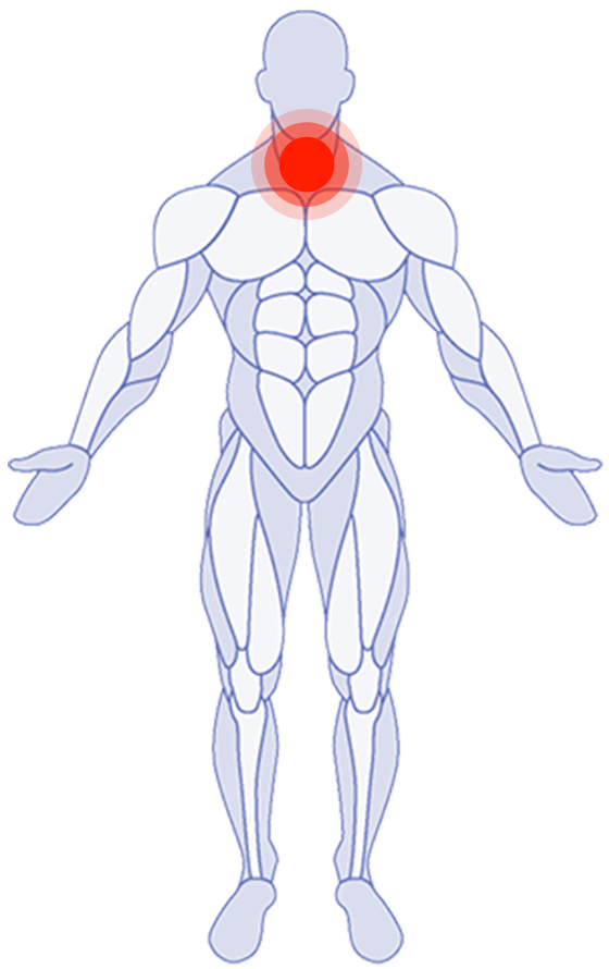 Parte del corpo anteriore: Cervicale